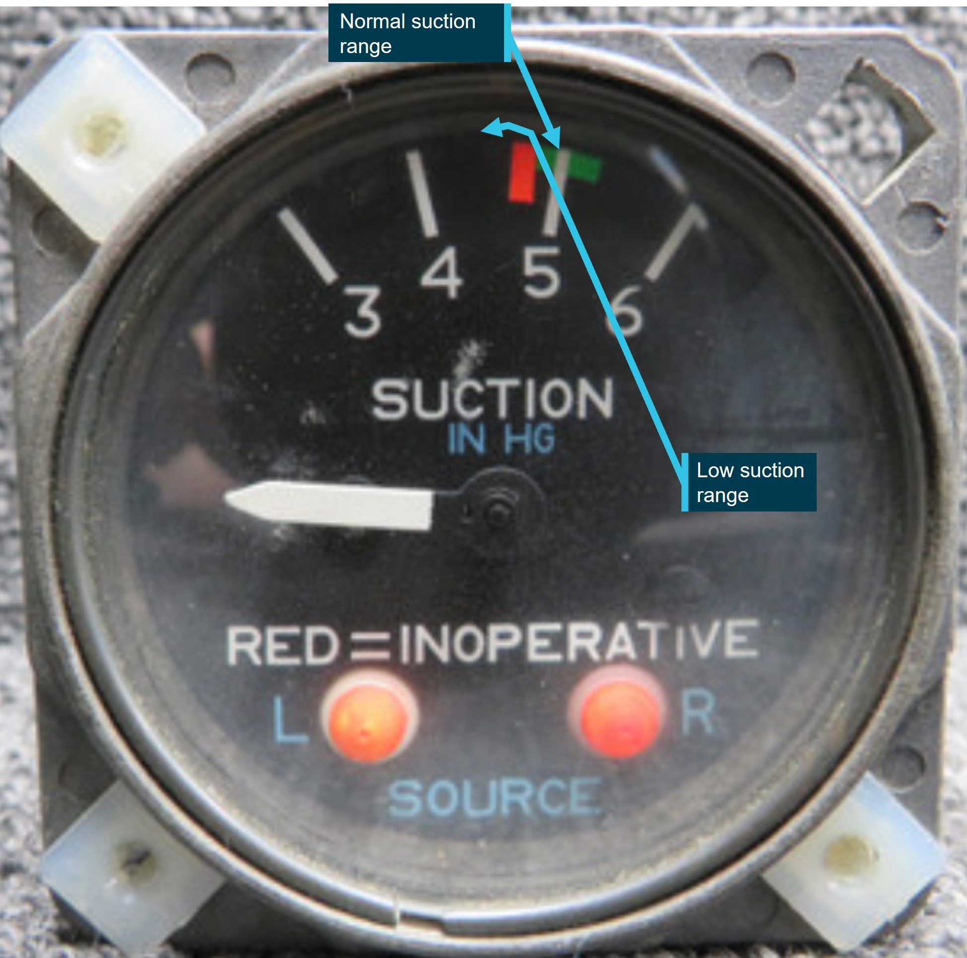 Figure&nbsp;6: Example of the suction gauge