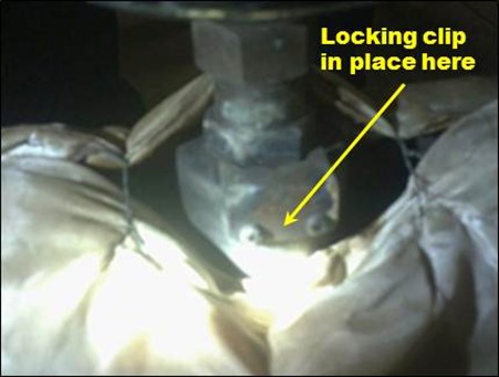 Figure 4: Similar valve with locking clip