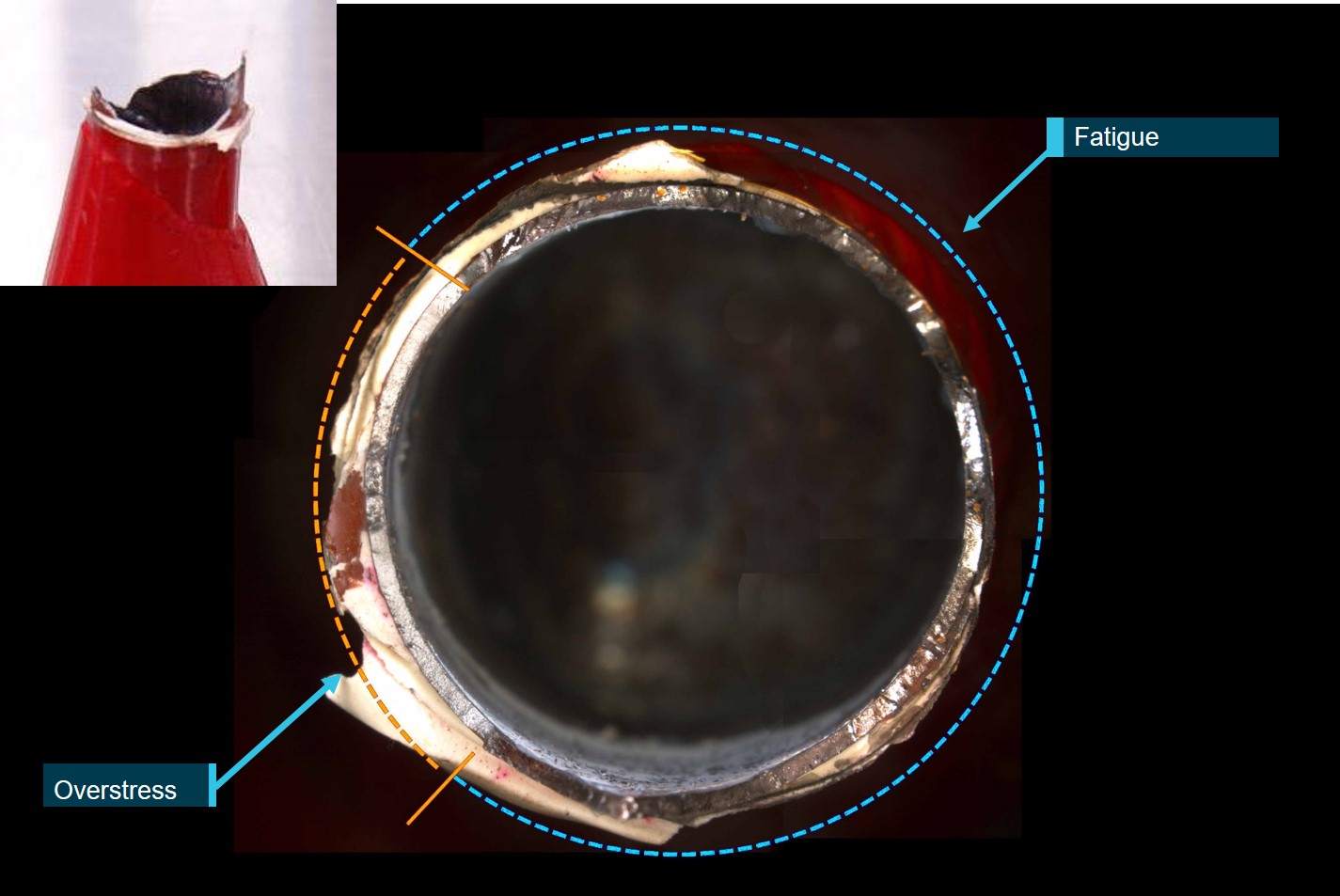 Figure 6: Stabiliser fracture surface showing fatigue and overstress areas.Source:  ATSB