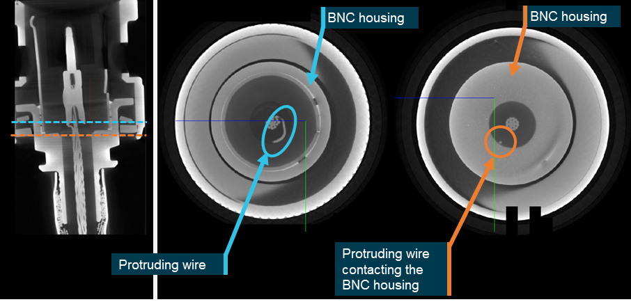 Figure 47: An X-ray of the RF cable BNC connector identified a single RF cable wire protruding from the connector pin (prior to destructive examination)